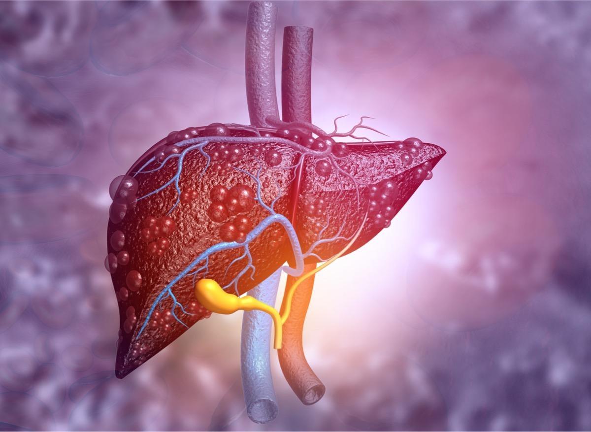 Cancer du foie : une hormone est capable d’empêcher la progression des tumeurs