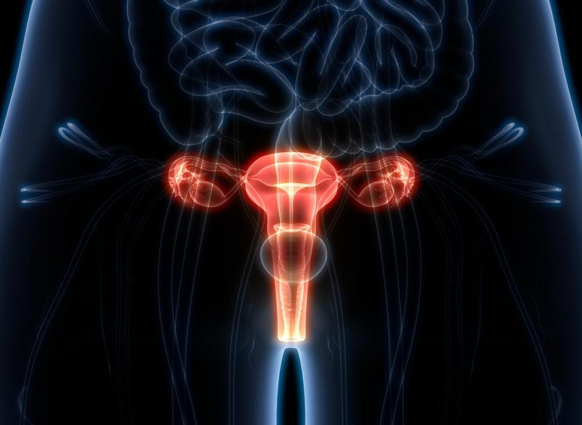 Cancer de l’ovaire : un algorithme peut identifier précocement les lésions à haut risque