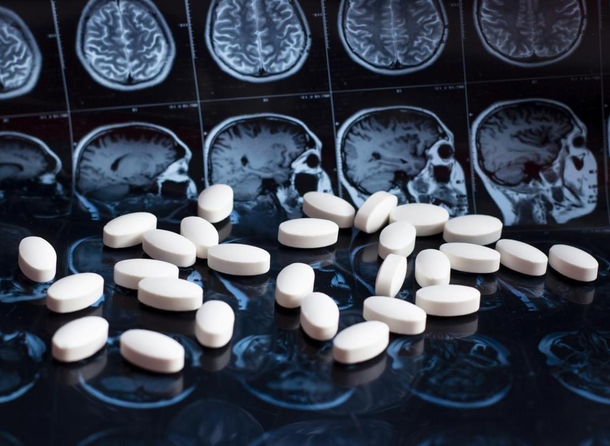 Alzheimer : les États-Unis autorisent un nouveau médicament très attendu