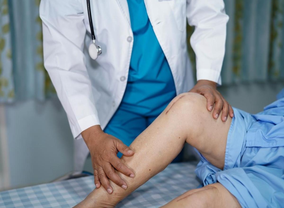Arthrose du genou : l’ostéotomie tibiale peut être une alternative à l’arthroplastie 