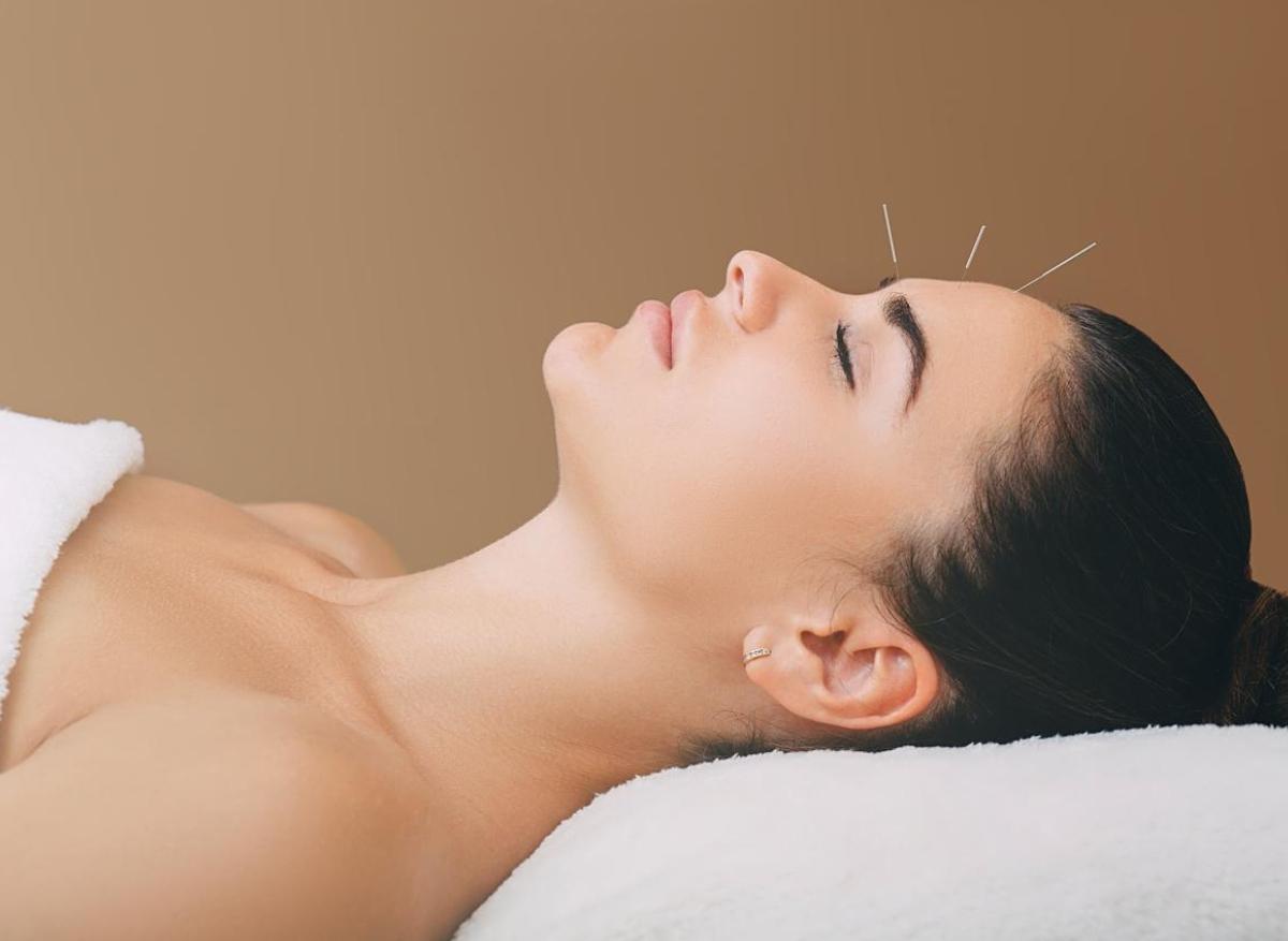 L’acupuncture efficace pour réduire les maux de tête chroniques