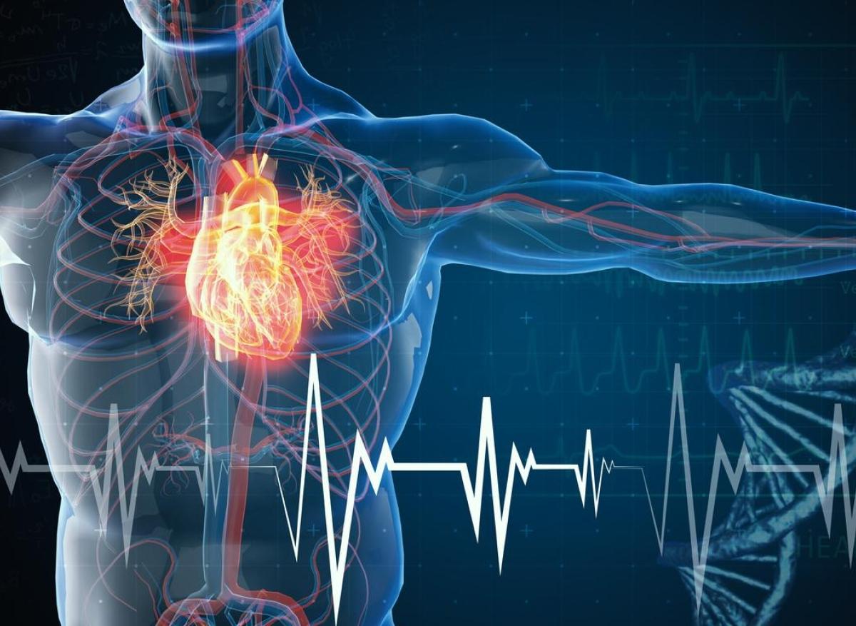 Mort subite de l'adulte : un gilet cardiaque pourrait aider à prédire le risque