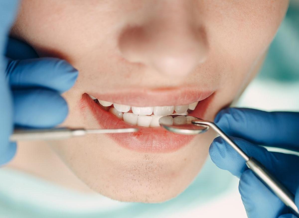 « Manquements aux règles d’hygiène » : les patients d’un cabinet dentaire invités à se faire dépister