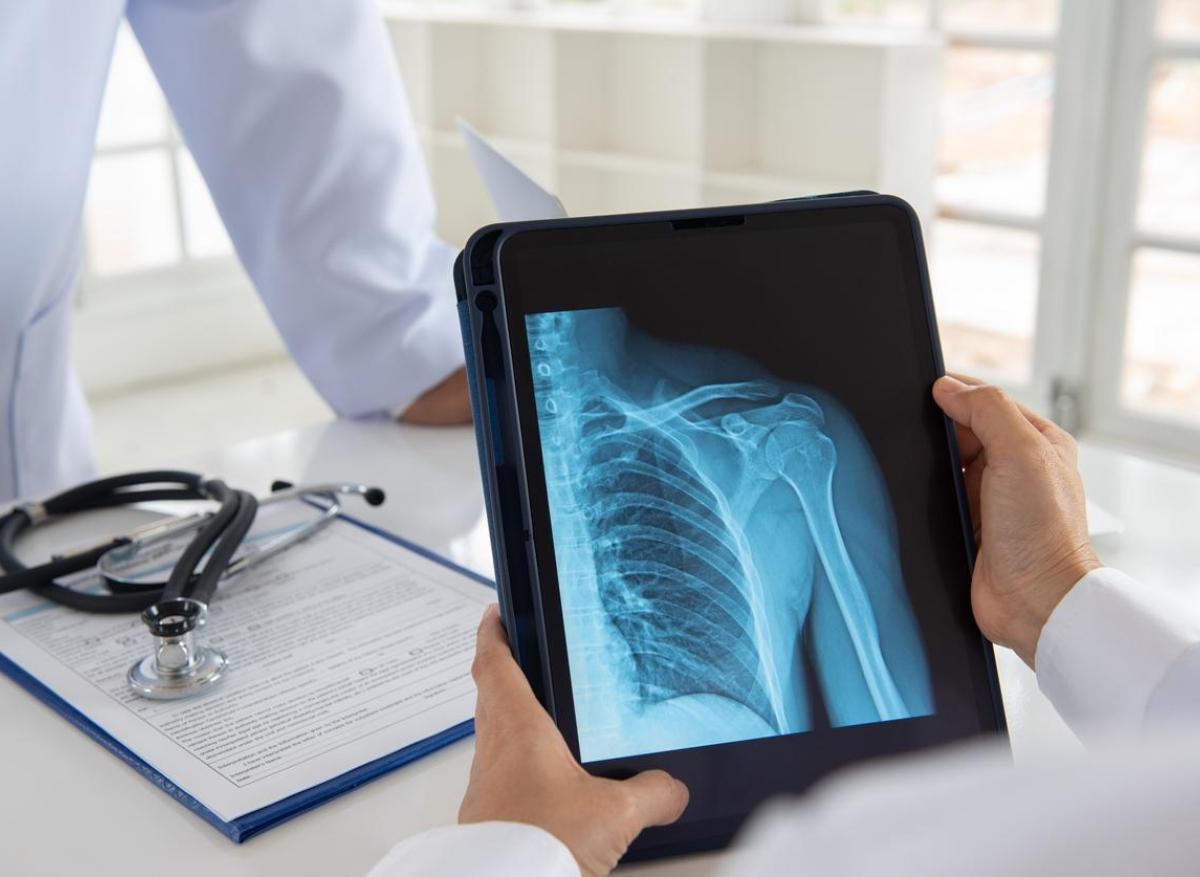 Ostéoporose : l’exposition aux PFAS en cause ? 