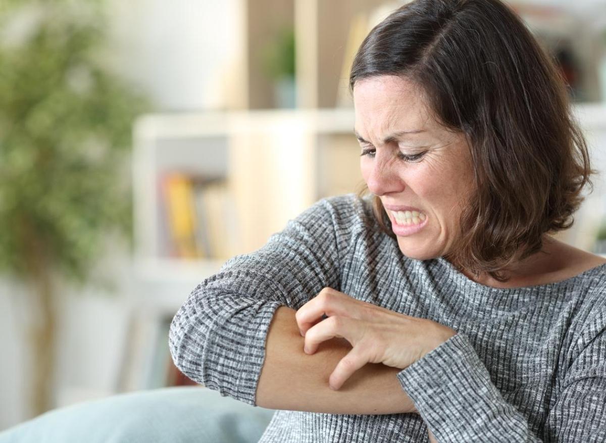 Eczéma, psoriasis, vitiligo... Les dermatoses visibles embarrassent fortement les malades