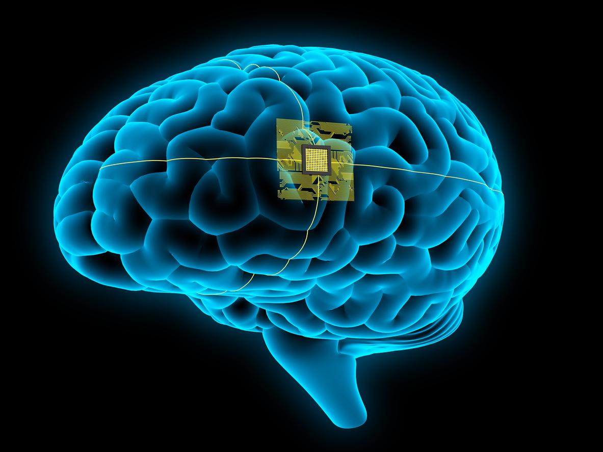 Un patient atteint de SLA retrouve la voix grâce à un implant Neuralink