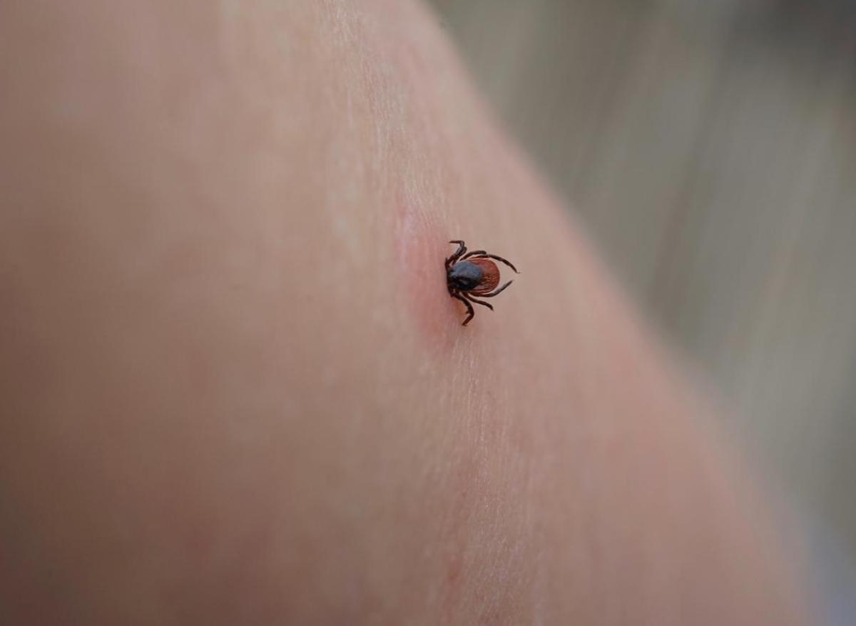 Tiques : plus de 14 % de la population mondiale a eu la maladie de Lyme