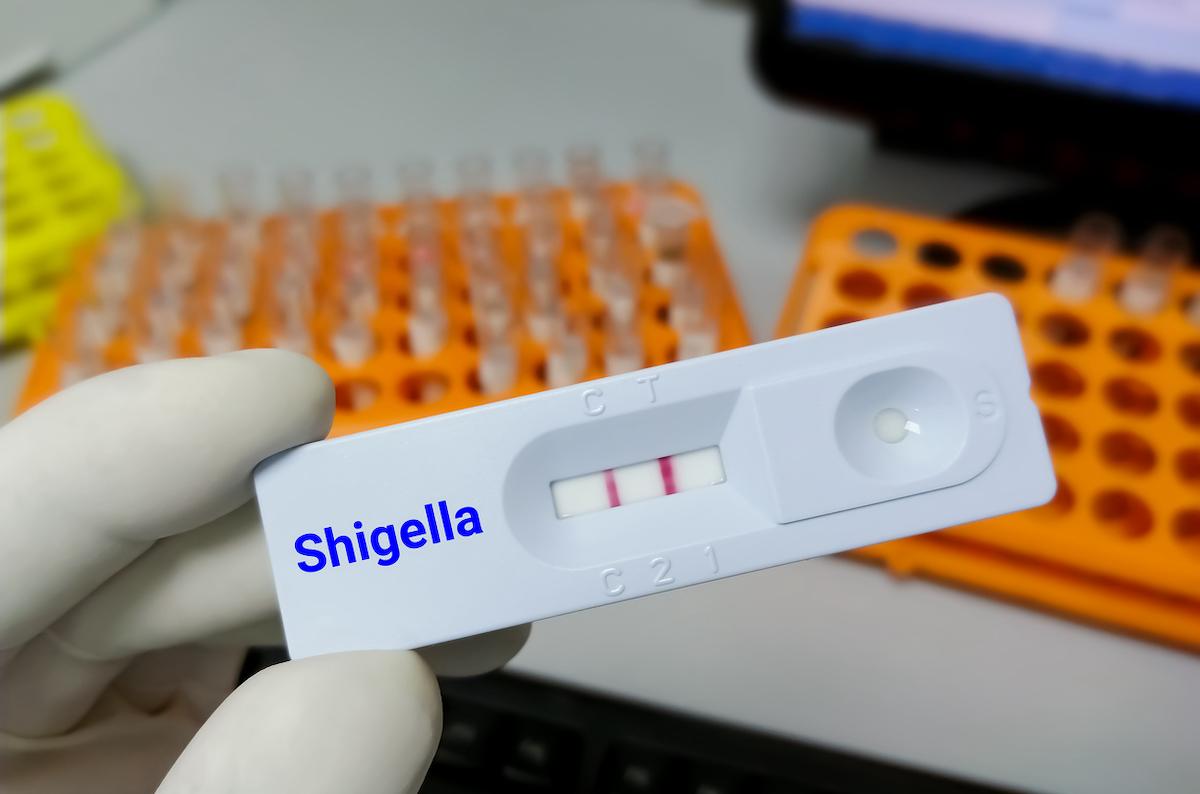 Shigellose antibiorésistante : vers une épidémie d’origine cap verdienne ?