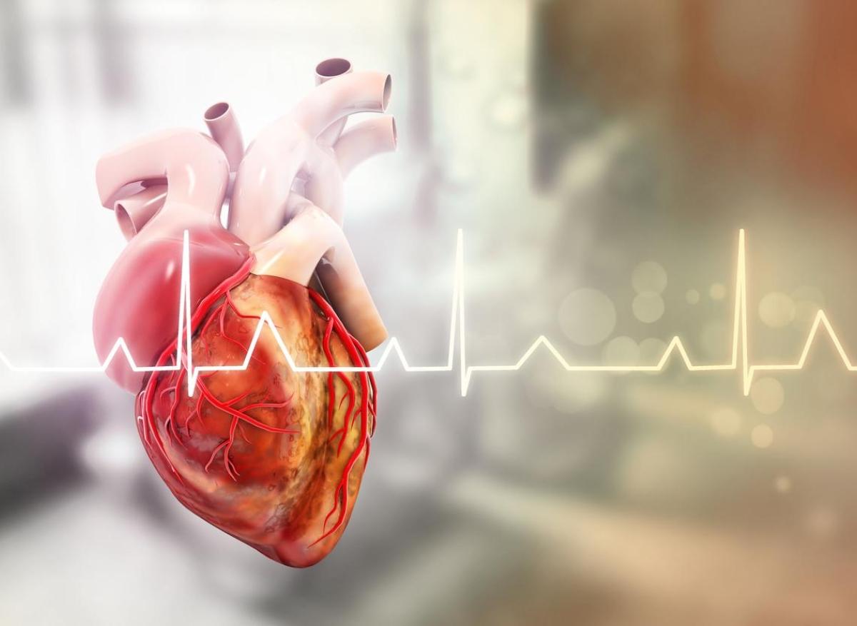 Fibrillation atriale : en quoi consiste le traitement chirurgical ? 