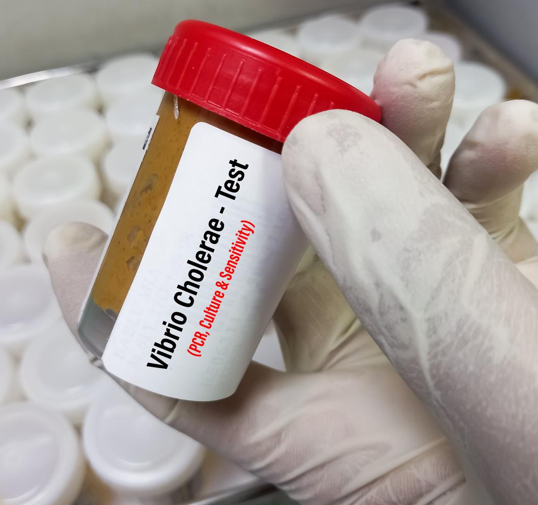 Mayotte intensifie la lutte contre le choléra avec l’autorisation des TROD en pharmacie