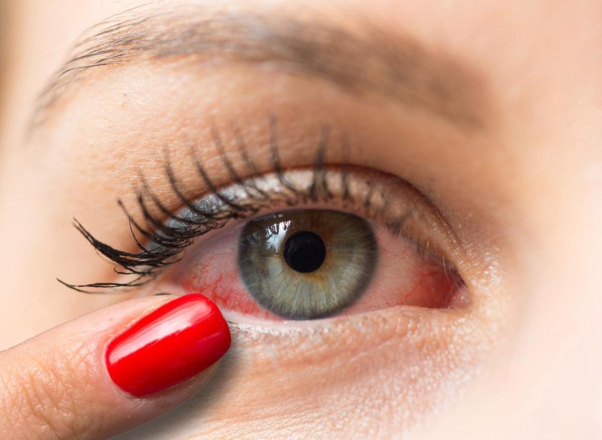 Hausse des infections oculaires : quelles sont les causes ? 