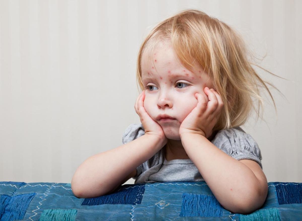 Rougeole : des millions d'enfants en danger suite à la baisse de la vaccination