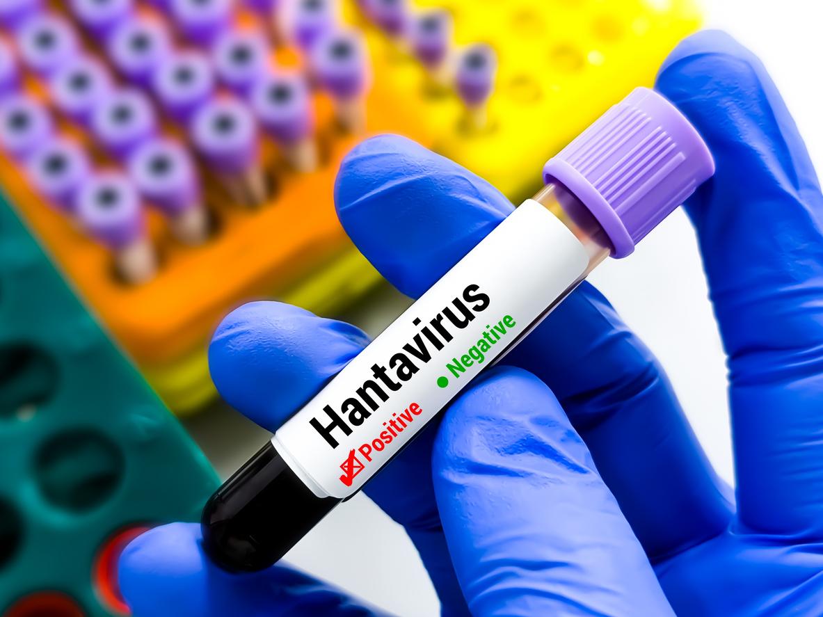 Hantavirus : un cas détecté après un séjour en France
