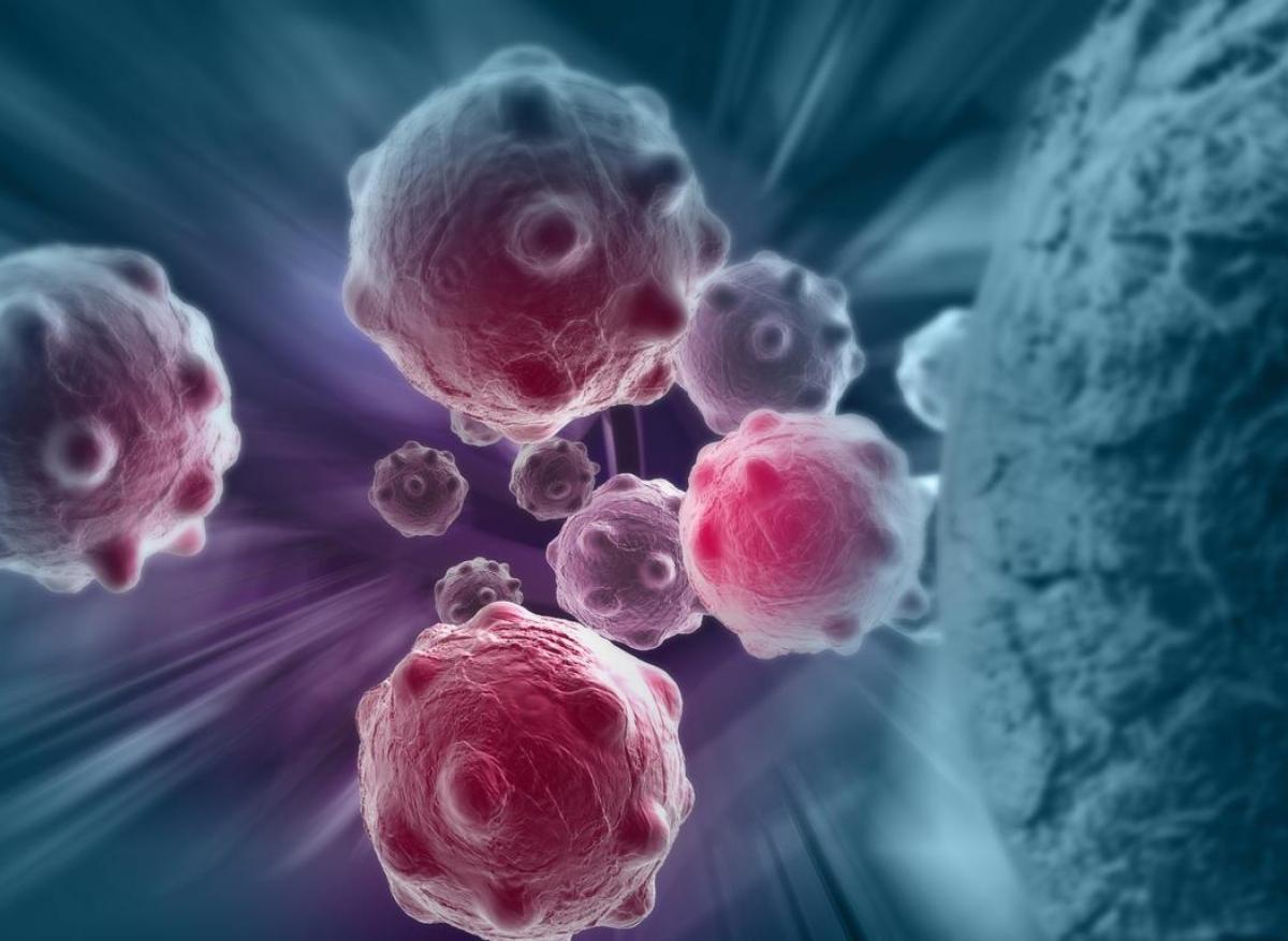 Cancer : une nouvelle méthode permet d'estimer le degré de malignité d'une tumeur