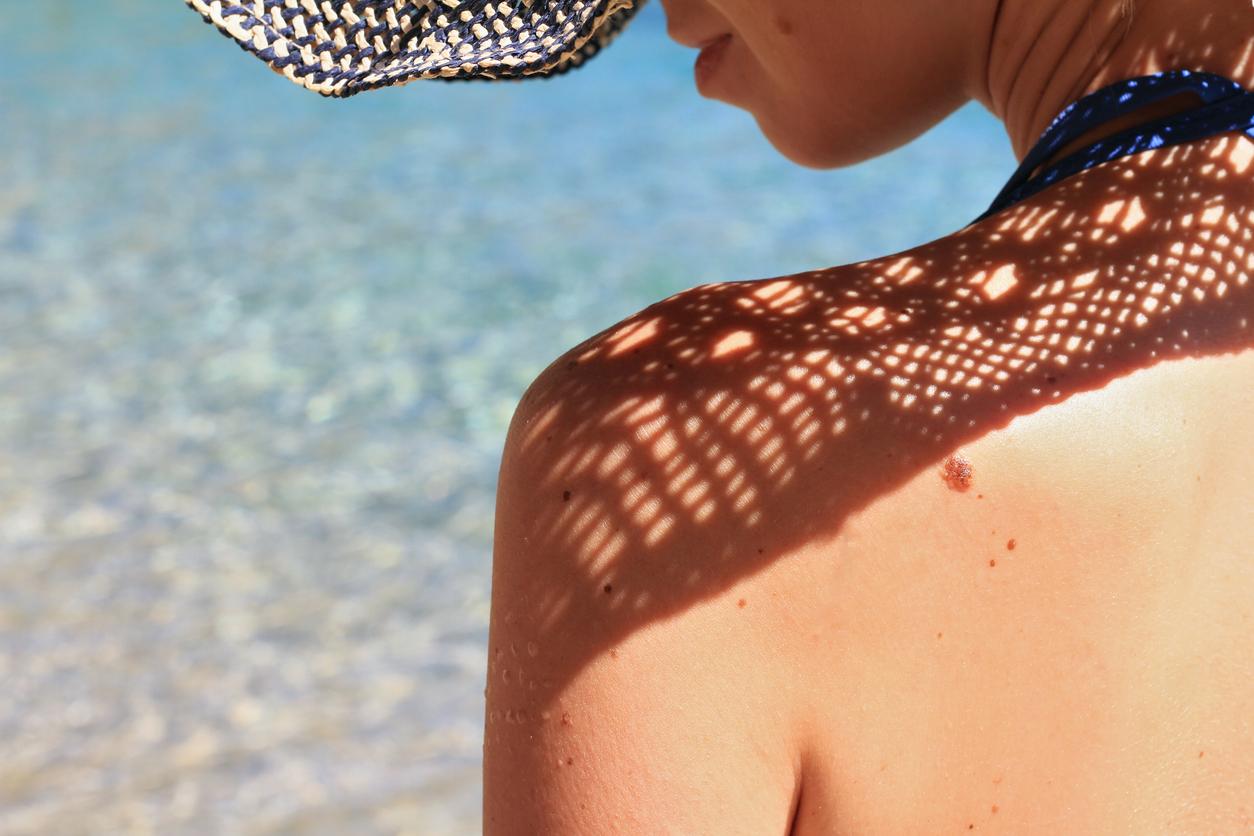 Le microbiote cutané aide à protéger la peau du soleil