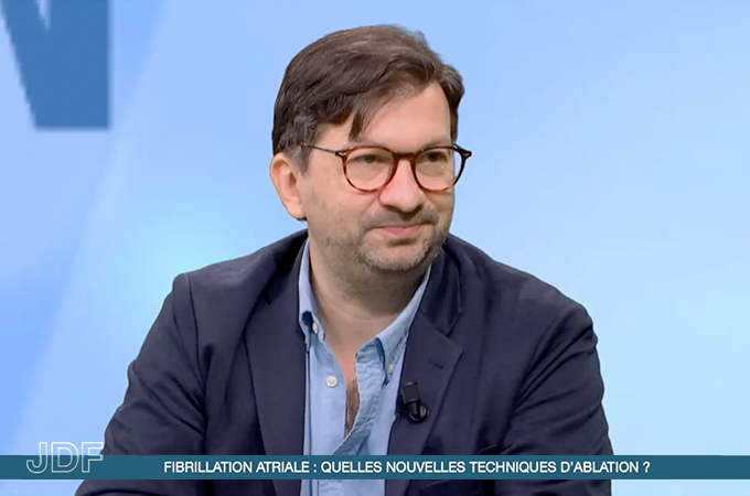 Fibrillation atriale : quelles nouvelles techniques d’ablation ?